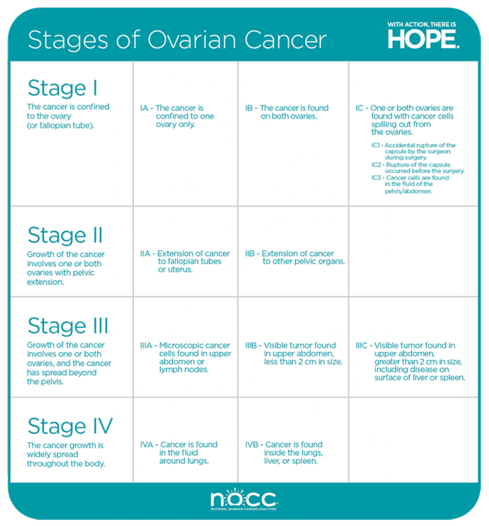 ovarian cancer thesis topics