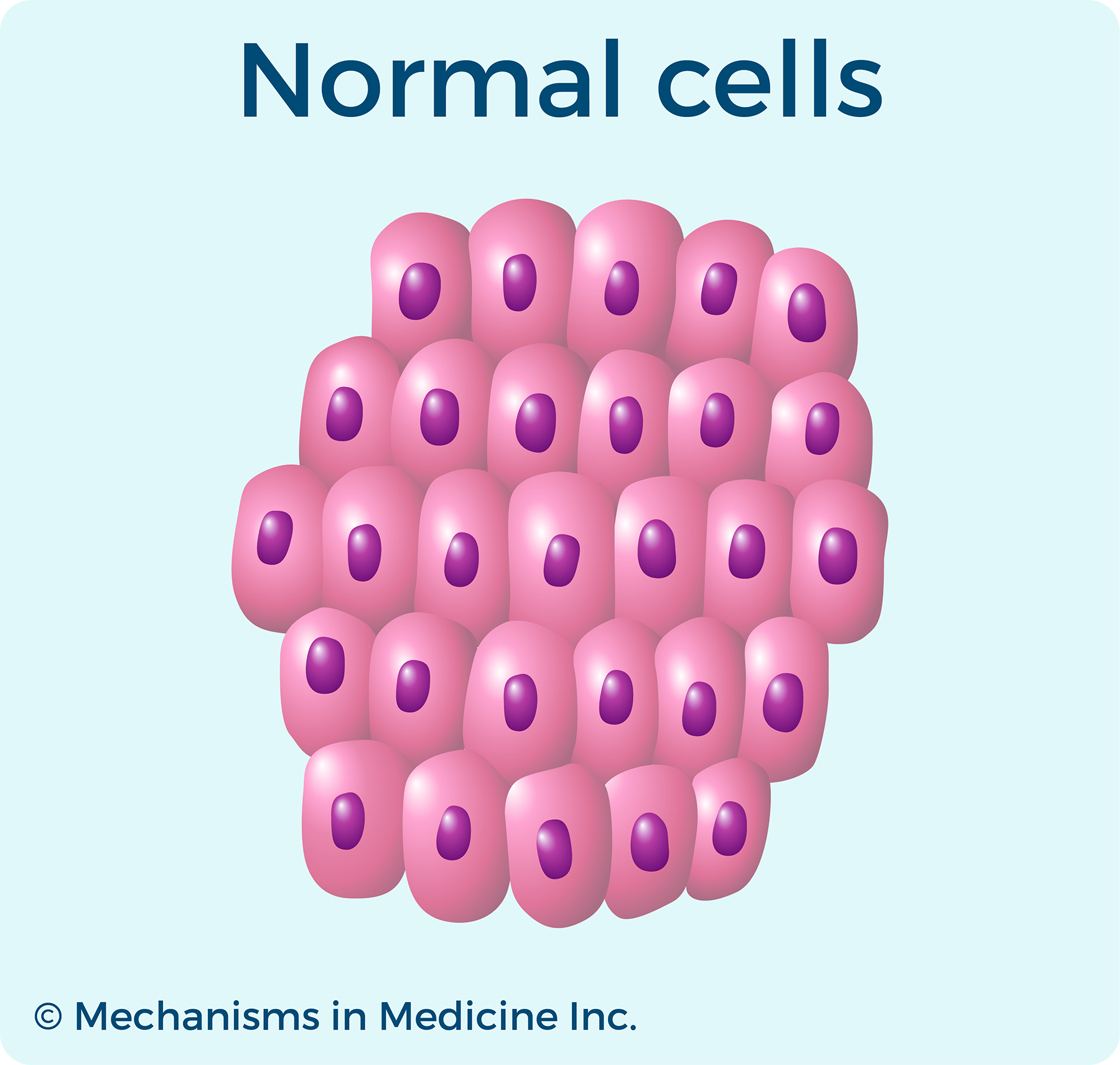 Grading Ovarian Cancer | Normal Cells